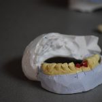 A természetes cirkon korona előnyei